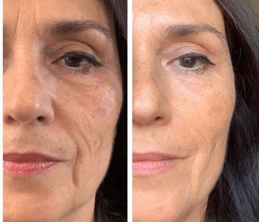 Comment booster naturellement la production de collagène ?