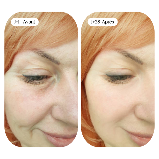 Soins Anti-Rides Naturels : Collagène et Astuces