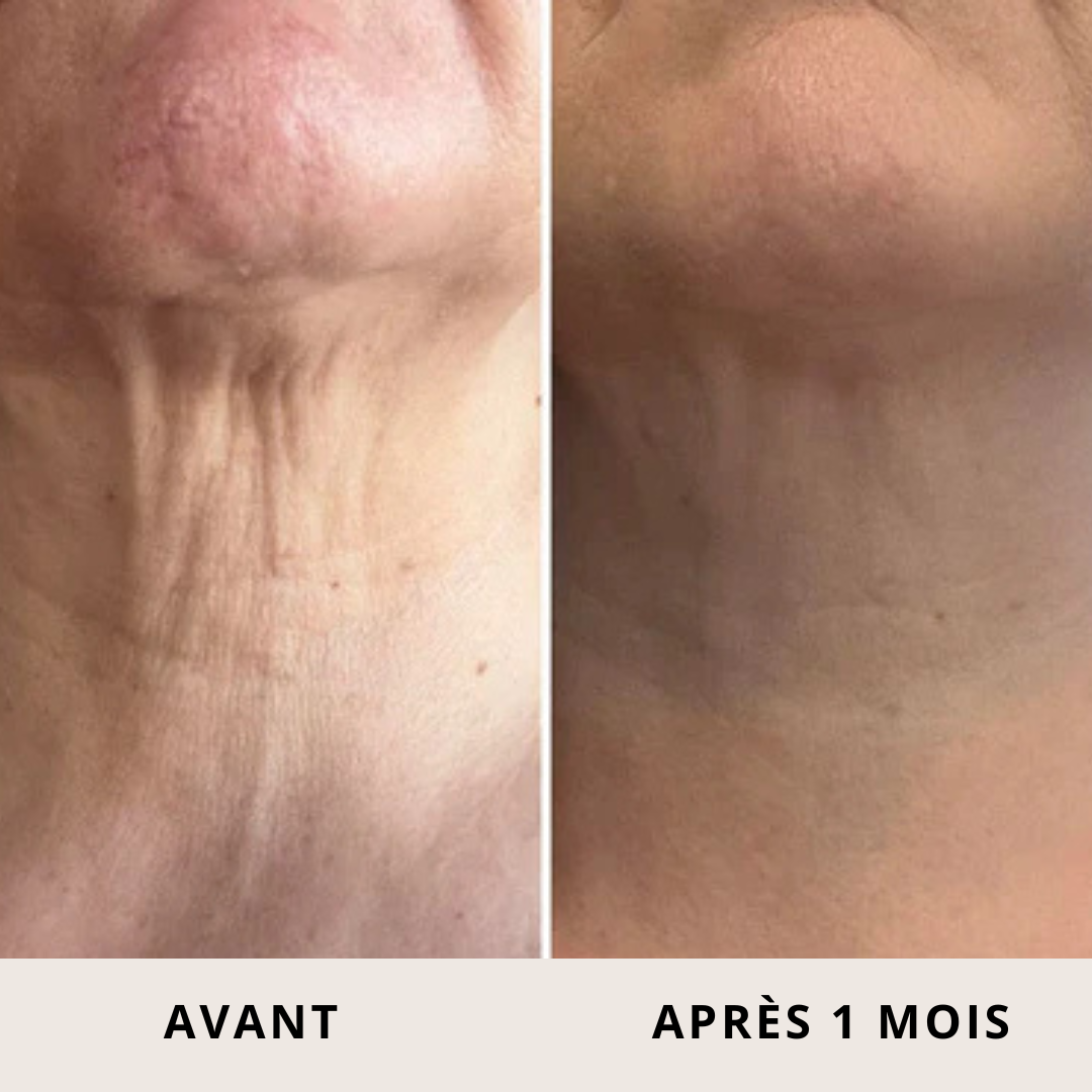 Crème Raffermissante Roll-On
