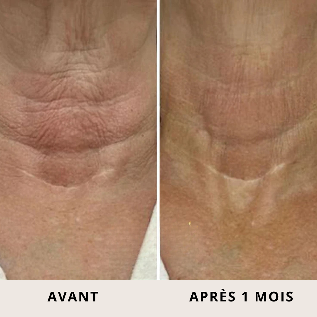 Crème Raffermissante Roll-On