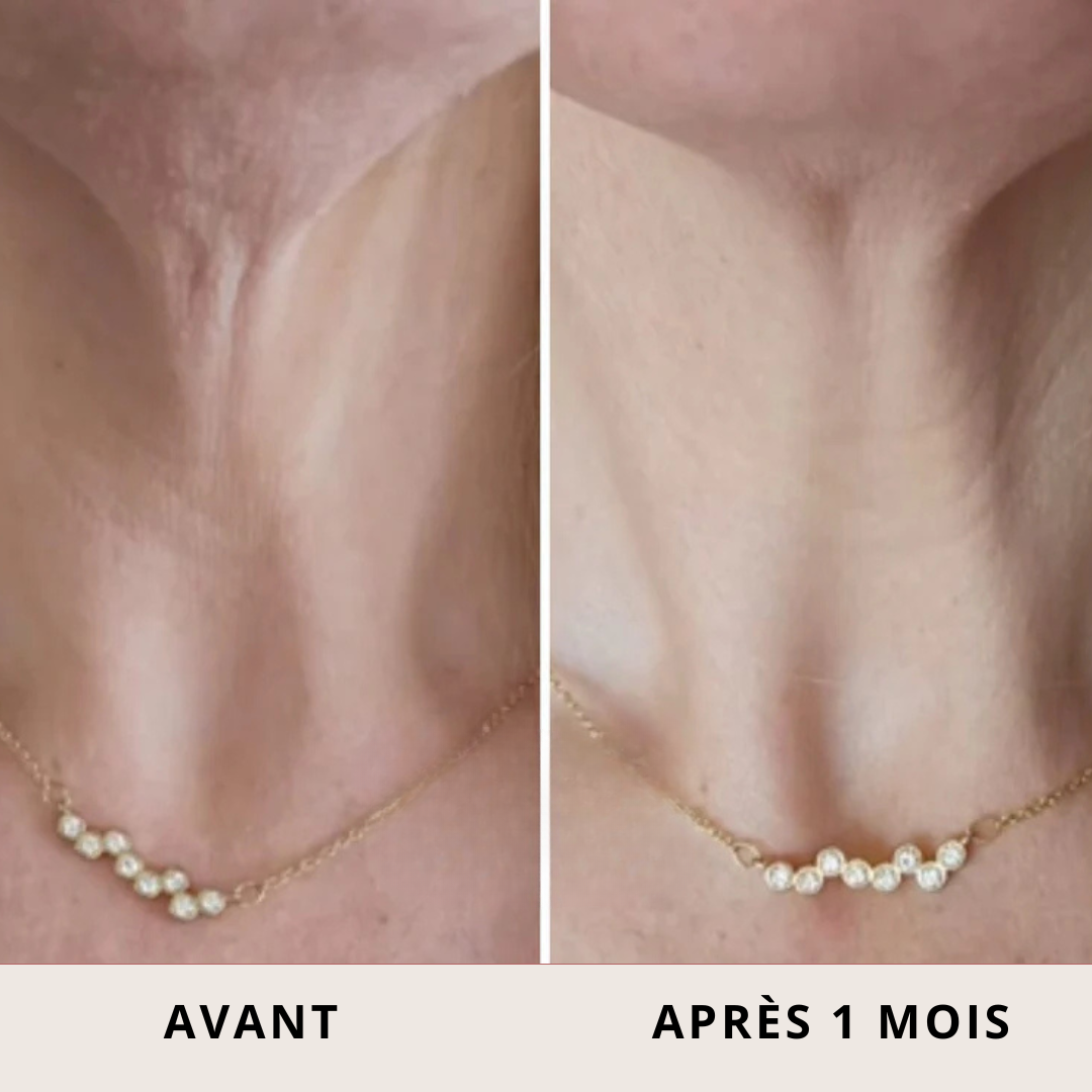 Crème Raffermissante Roll-On