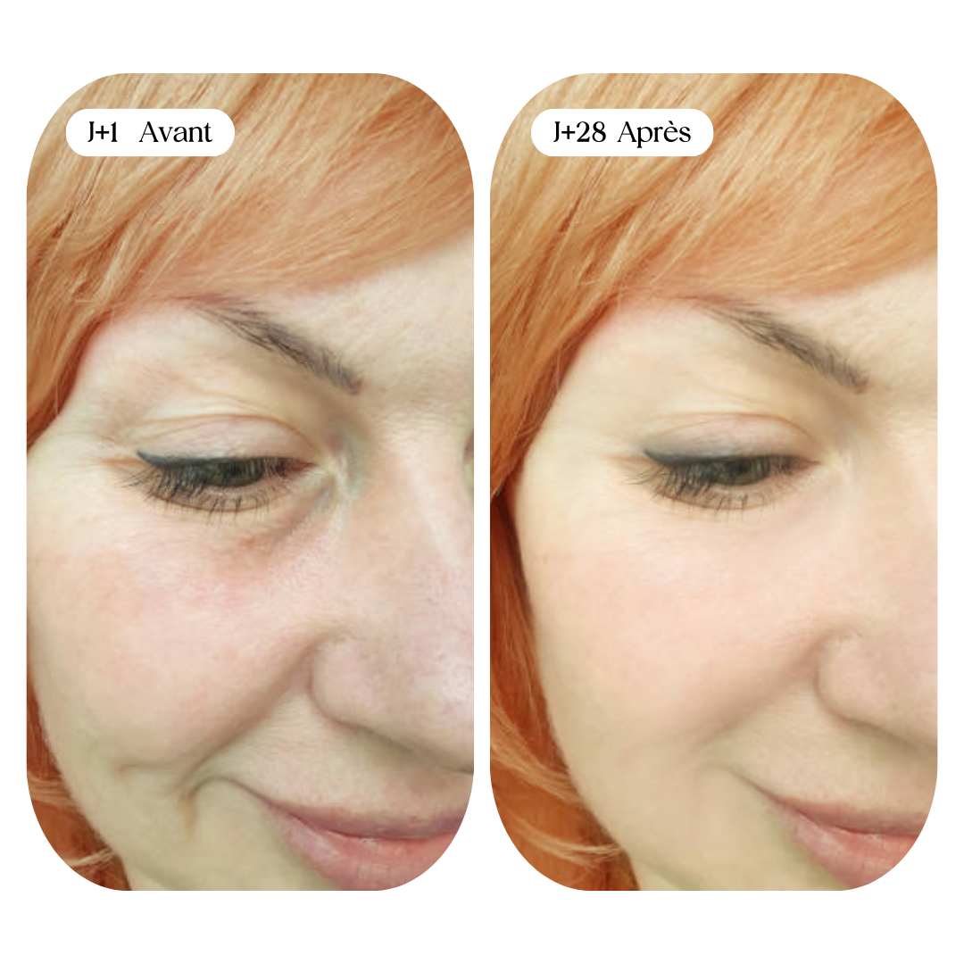 Soins Anti-Rides Naturels : Collagène et Astuces