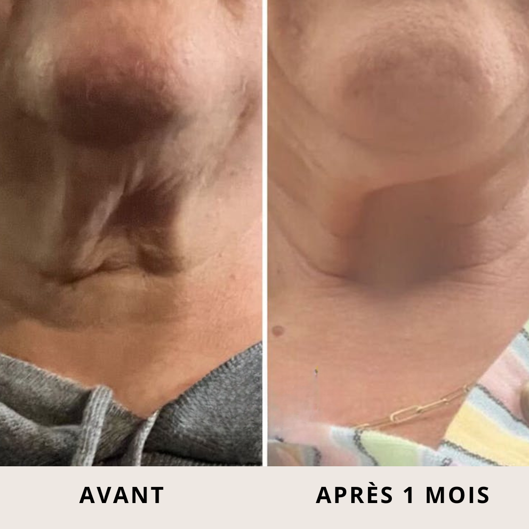 Crème Raffermissante Roll-On